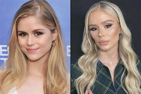 erin moriarty after surgery|Erin Moriarty Was Slammed With Plastic Surgery。